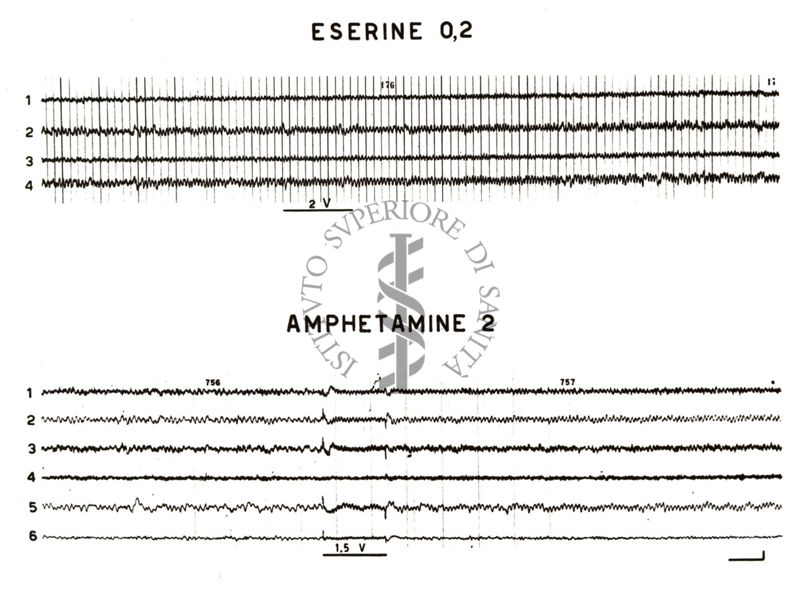 Elettroencefalogramma. Due gruppi di tracciati, sopra il primo è scritto: eserine 0,2: sopra il secondo gruppo è scritto: amphetamine 2