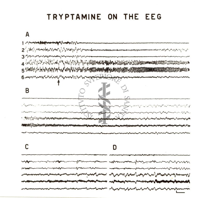 Elettroencefalogramma. Tre gruppi di tracciati su cui è scritto: tryptamine on the EEG