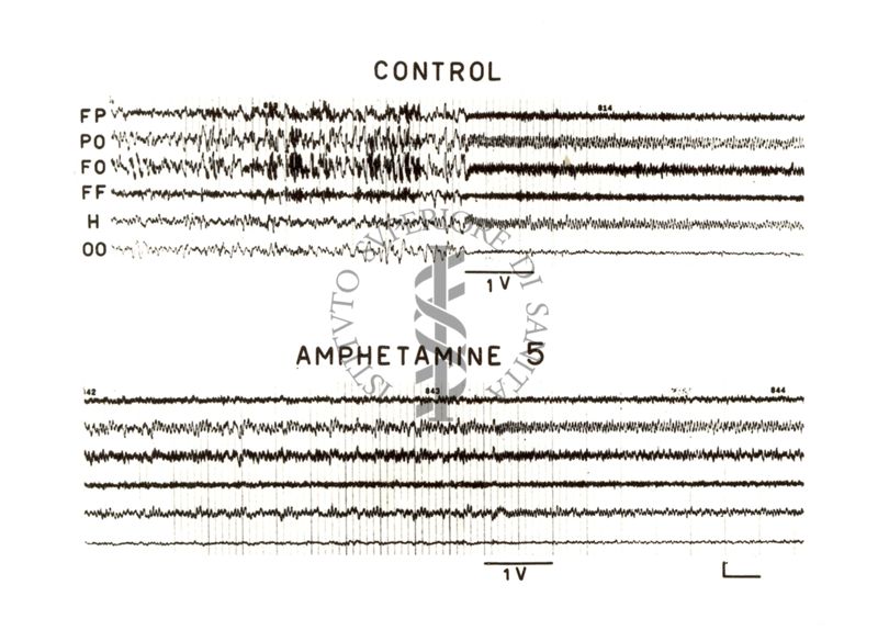Elettroencefalogramma. Due gruppi di tracciati, sul primo gruppo è scritto: control; sul secondo gruppo è scritto: amphetamine 5
