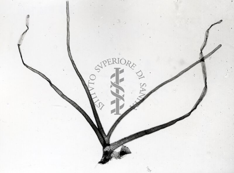 Foto del filamento respiratorio pupale di dittero Simulide di Simulium sp. (probabilmente  sottogenere Nevermannia, specie costatum)