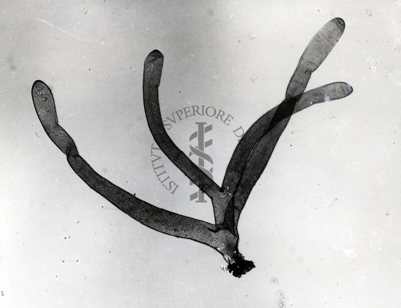Foto del filamento respiratorio pupale di dittero Simulide di Simulium sp. (probabilmente  sottogenere Obuchovia, specie auricoma)
