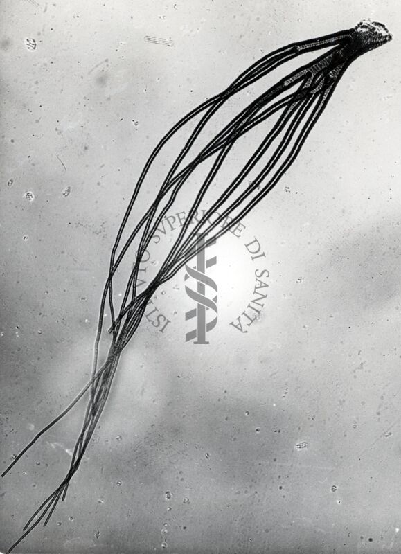 Foto del filamento respiratorio pupale di dittero Simulide di Simulium sp. (probabilmente  sottogenere Nevermannia, specie vernum)