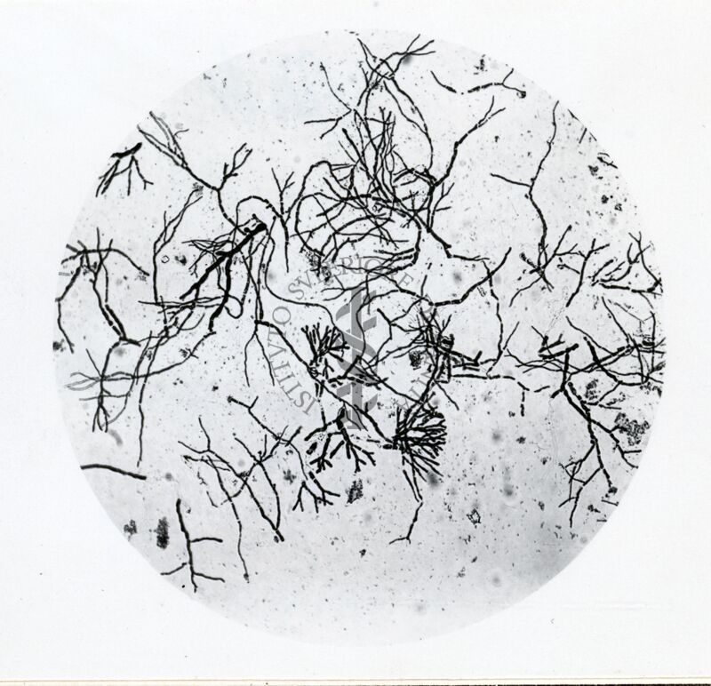 Forme di Penicilium Chrysogenum in coltura sommersa