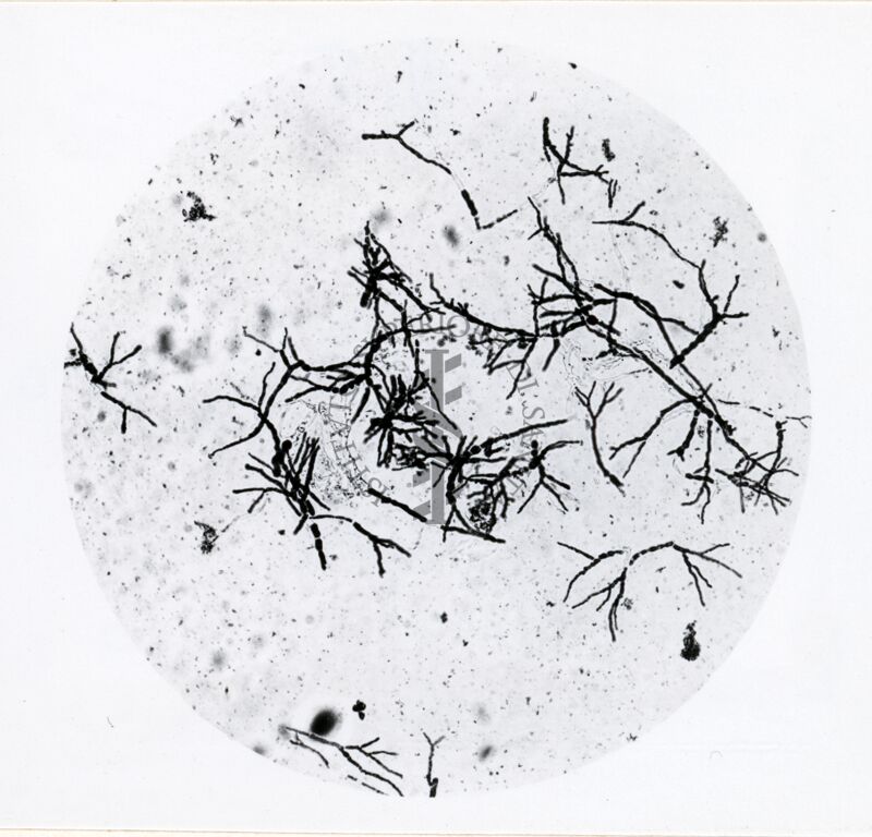 Forme di Penicilium Chrysogenum in coltura sommersa