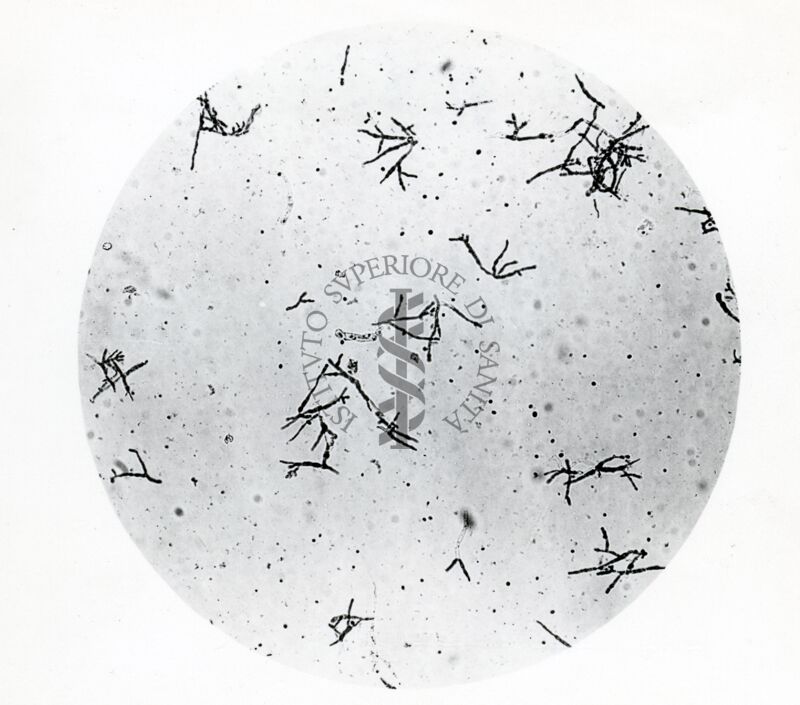 Forme di Penicilium Chrysogenum in coltura sommersa