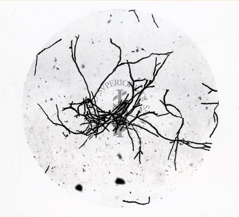 Forme di Penicilium Chrysogenum in coltura sommersa