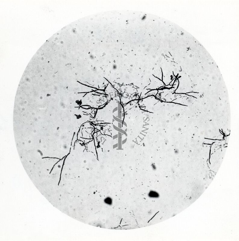 Forme di Penicilium Chrysogenum in coltura sommersa