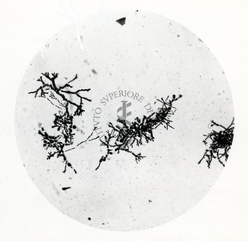 Forme di Penicilium Chrysogenum in coltura sommersa