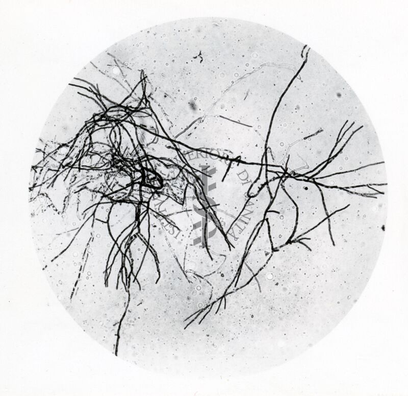 Forme di Penicilium Chrysogenum in coltura sommersa