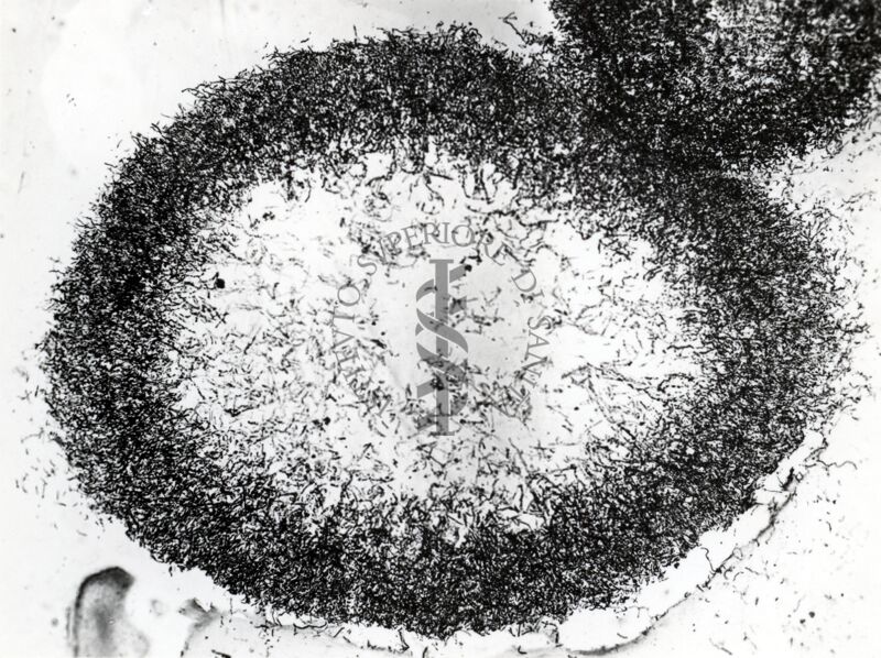 Forme di Penicilium Chrysogenum in coltura sommersa