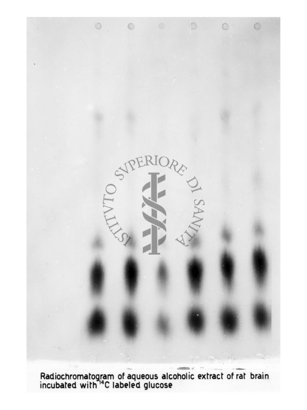 Metabolismo del Glucosio