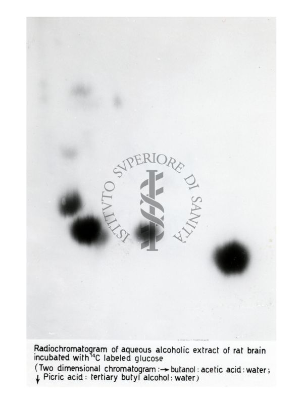 Metabolismo del Glucosio