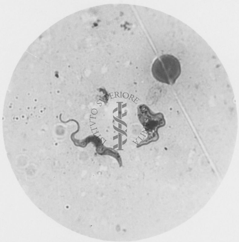 Trypanosoma gambiense - ?