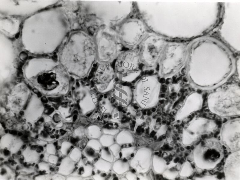 Sezioni di segala infettata da Claviceps