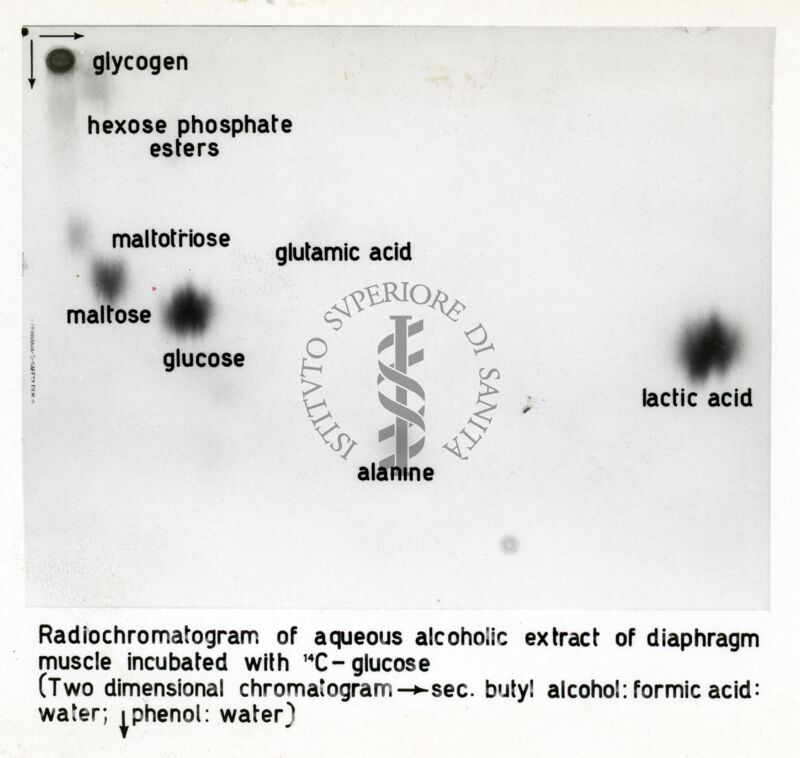 Metabolismo del glucosio nel diaframma di ratto