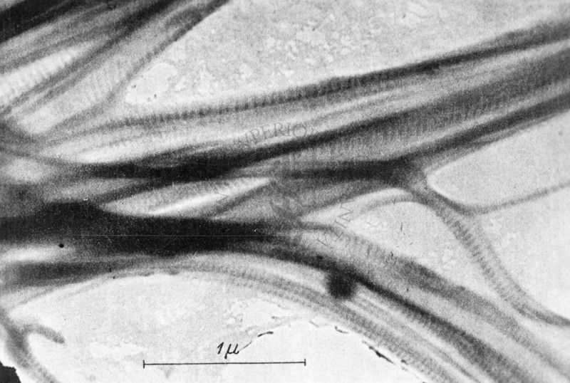 Fibre di collagene osservate al microscopio elettronico a trasmissione.