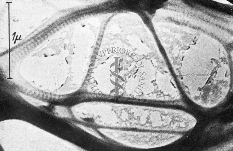 Fibre di collagene osservate al microscopio elettronico a trasmissione.