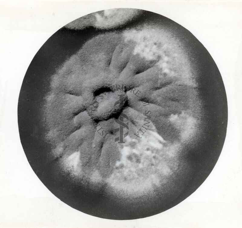 Colonie di Penicillium Chrysogenum