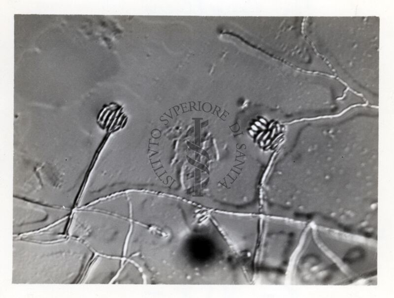 Cephalosporium serrae: conidiofori