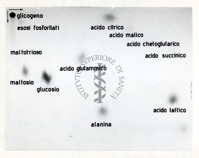 Radiocromatografia di estratto di fegato incubato con piruvato 2 - 14C.