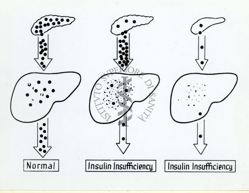 Diagramma sulla insufficienza insulinica