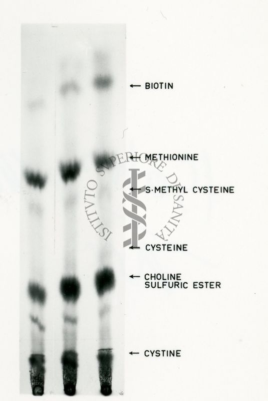 Passi fondamentali del metabolismo dello zolfo nei funghi ed in particolare in Penicillium Shrysogenum