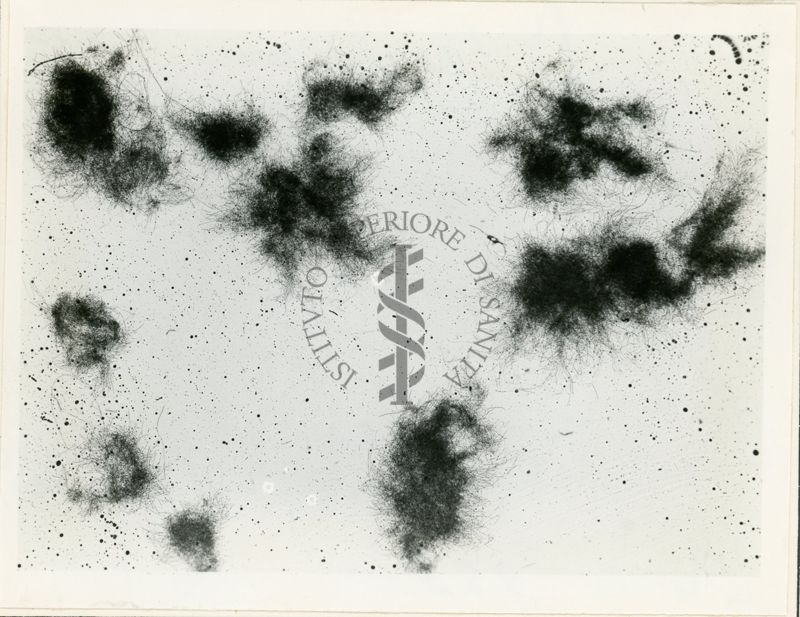 Micelio di Aspergillus niger in coltura sommersa