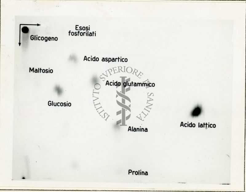 Metabolismo del glucosio 32 P nel diaframma di ratto