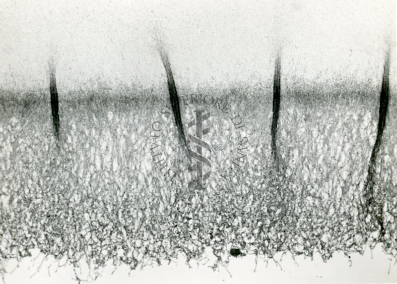 Microfotografia 100 ingrandimenti