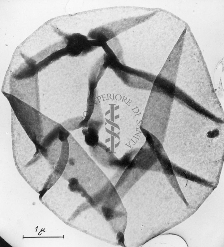 Membrana di globuli rossi vista al microscopio elettronico