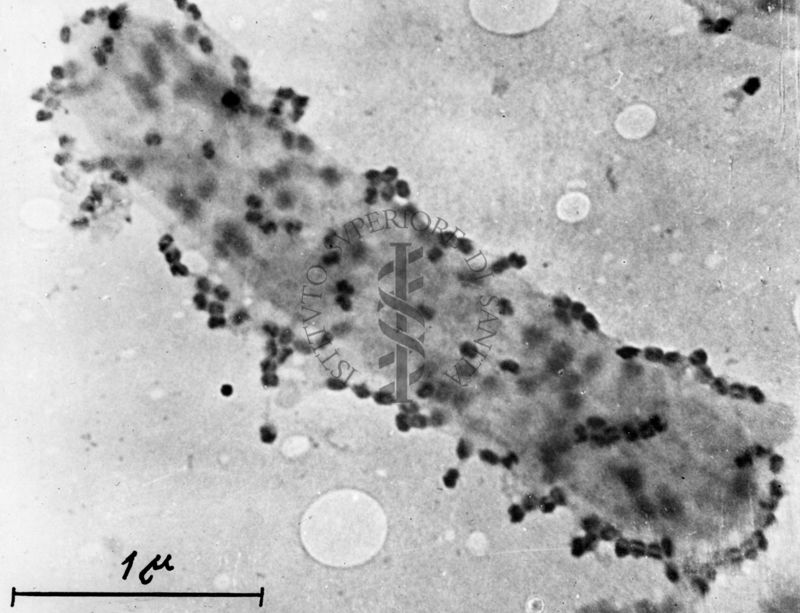 Batteriofagi visti al microscopio elettronico