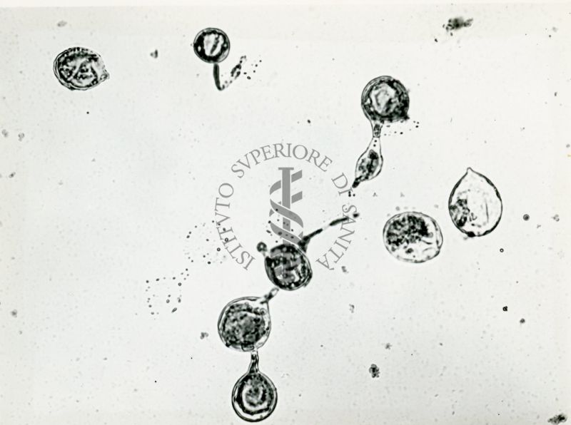 Microfotografia 190 ingrandimenti