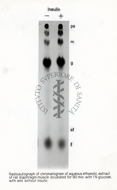 Radiografia glucosio 1% diaframma