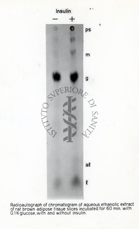 Radiografia - glucosio - adiposo bruno