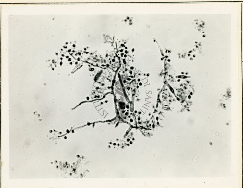 Microfotografia ingrandimenti 700