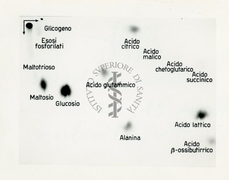 Metabolismo intermedio dei carboidrati