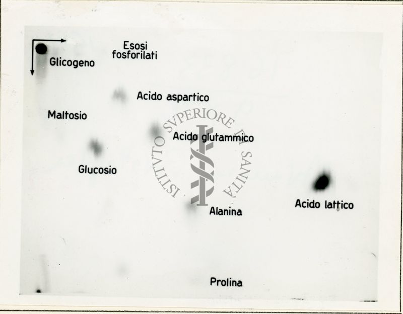 Metabolismo intermedio dei carboidrati