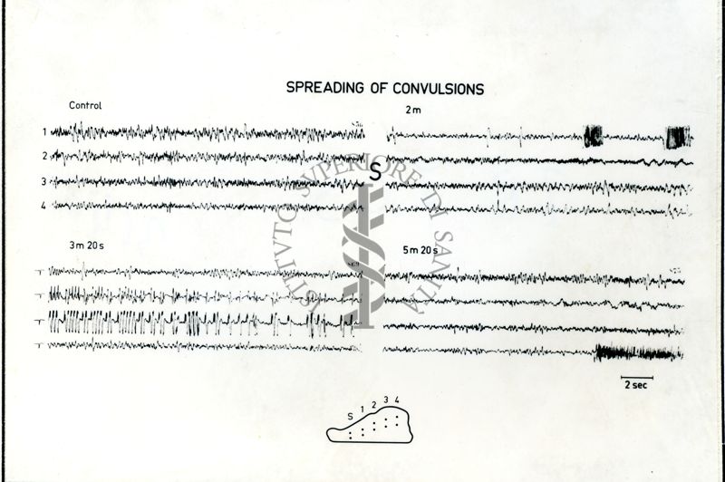 Immagine che ritrae l'andamento dell' EEG