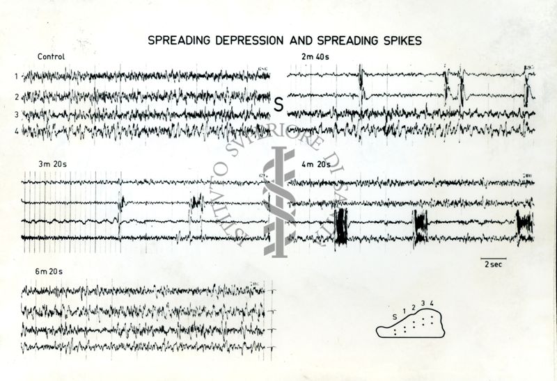 Immagine che ritrae l'andamento dell' EEG