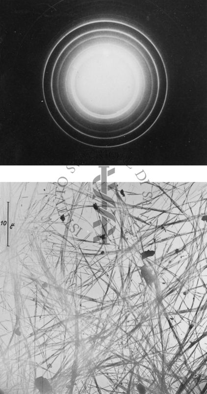 Strutture filamentose osservate al microscopio elettronico (in basso) e relativa immagine di diffrazione (in alto)