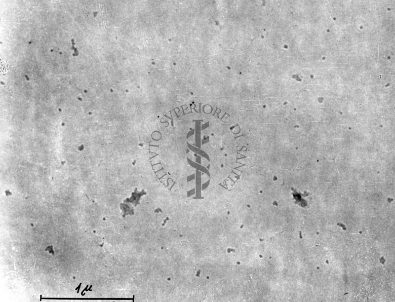Coltura batterica osservata al microscopio elettronico. Le cellule appaiono fortemente danneggiate, probabilmente a causa di infezioni da batteriofagi (piccoli granuli elettrodensi sulla superficie cellulare)