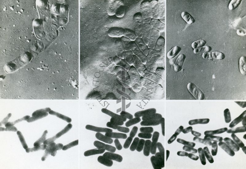 Escherichia coli, ceppo K 12 da Kellenberger