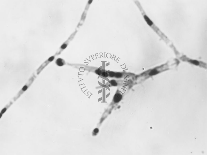 Nuclei di Penicillium Chrysogenum in cultura sommersa ingrandimento n. 2600