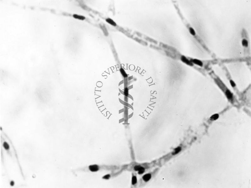 Nuclei di Penicillium Chrysogenum in cultura sommersa ingrandimento n. 2300