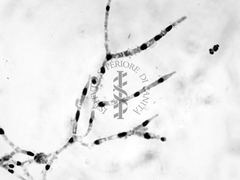 Nuclei di Penicillium Chrysogenum in cultura sommersa ingrandimento n. 1600