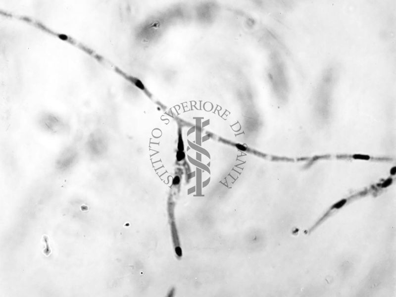 Nuclei di Penicillium Chrysogenum in cultura sommersa ingrandimento n. 1600