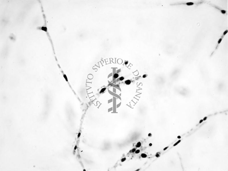 Nuclei di Penicillium Chrysogenum in cultura sommersa ingrandimento n. 1400