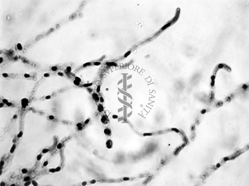 Nuclei di Penicillium Chrysogenum in cultura sommersa ingrandimento n. 1400