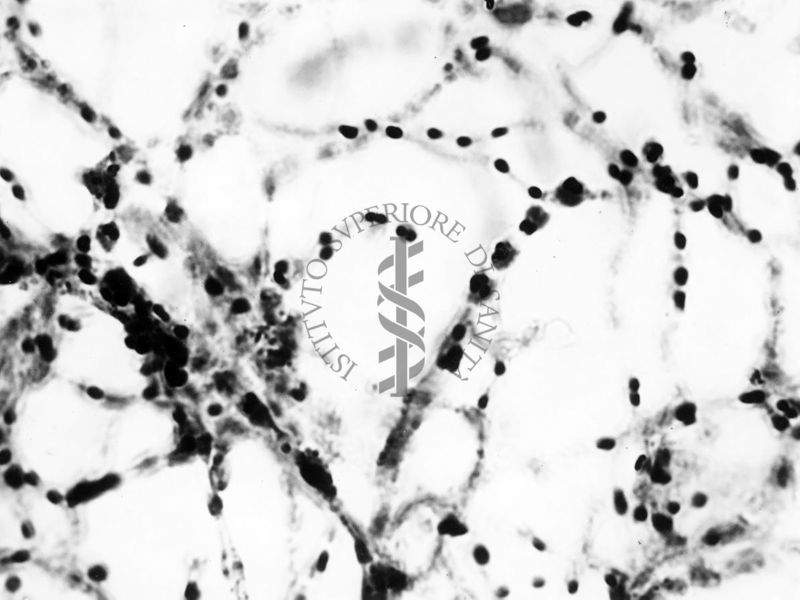 Nuclei di Penicillium Chrysogenum in cultura sommersa ingrandimento n. 1400