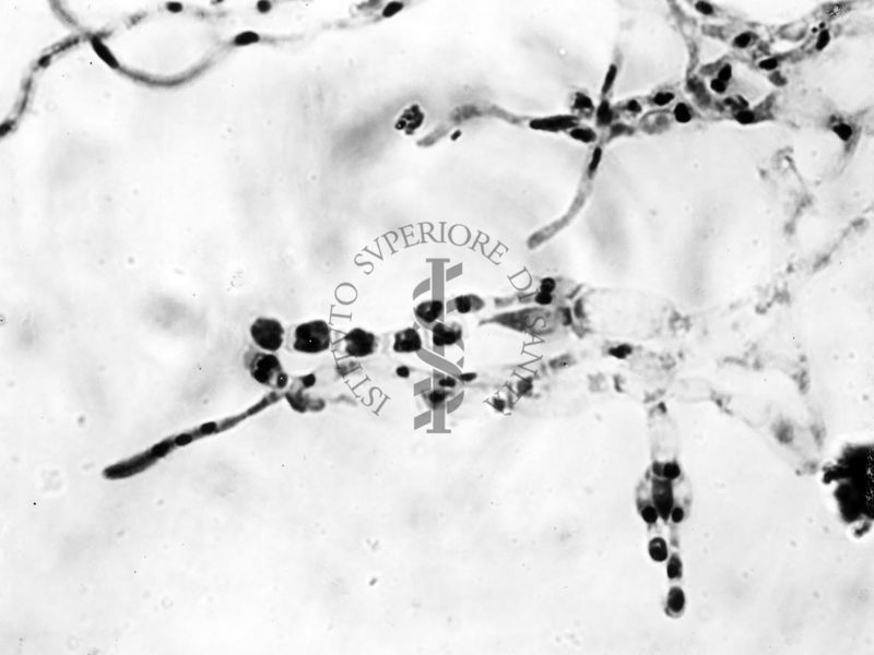 Nuclei di Penicillium Chrysogenum in cultura sommersa ingrandimento n. 1400